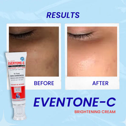 Eventone C Cream