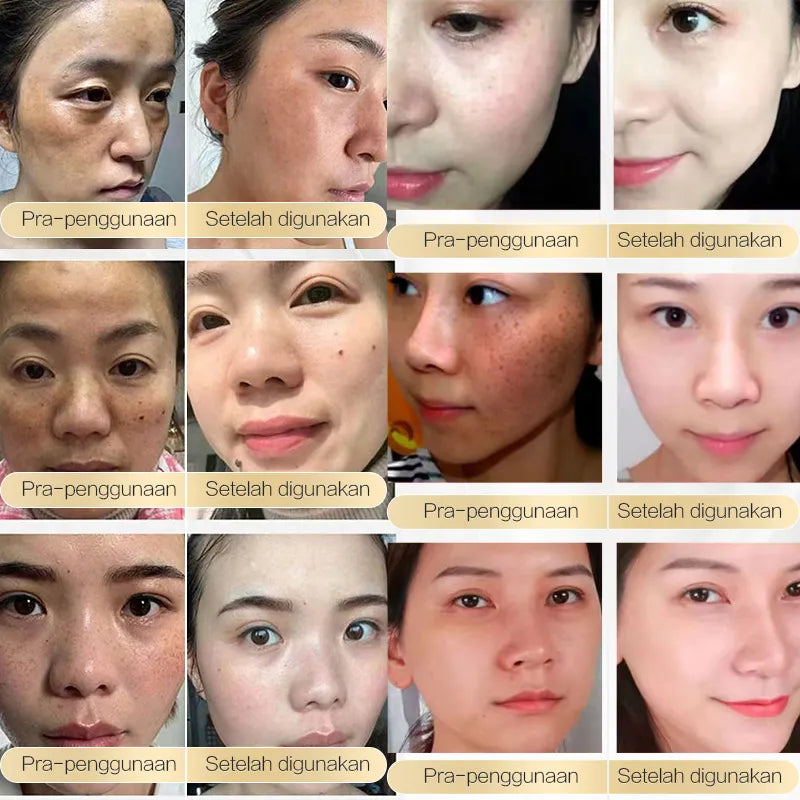 Chalonese Brightening Cream