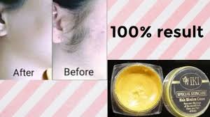 Wiki Hair remover cream